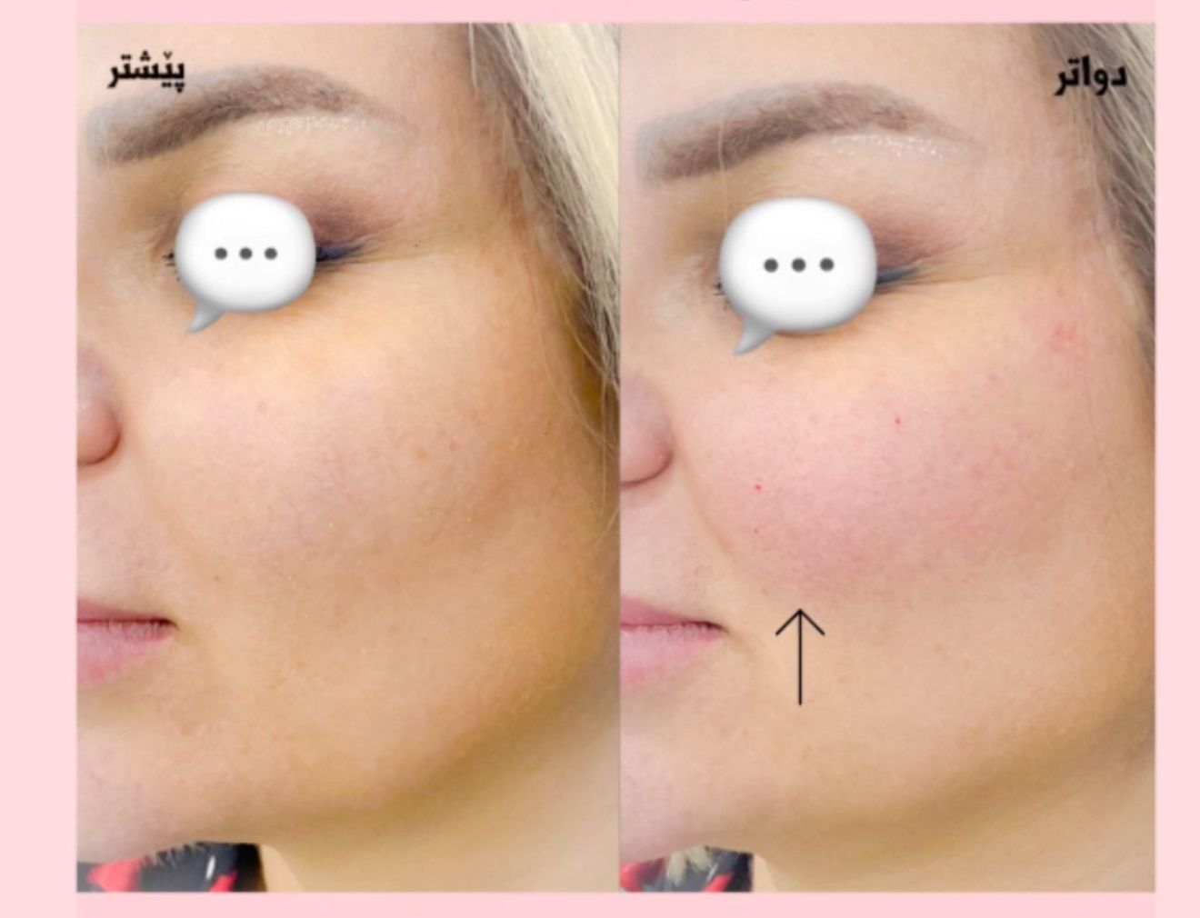 کۆنتووری ڕوومەت